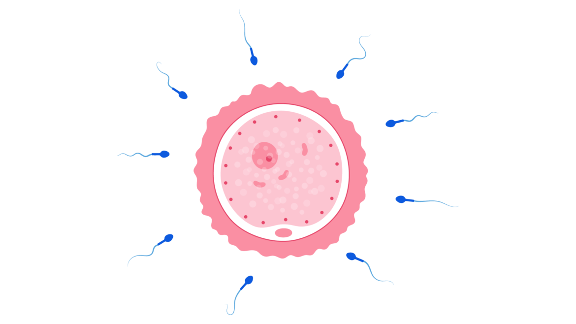 PESA-  Percutaneous Epididymis Sperm Aspiration