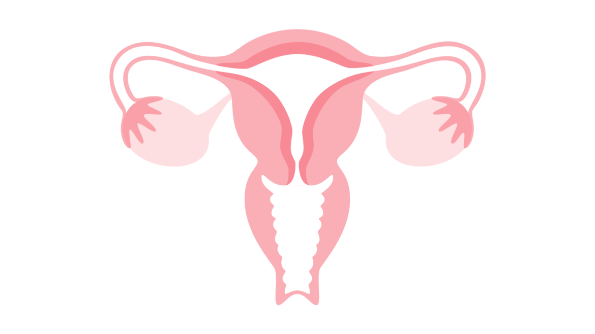 IUI -Intrauterine Insemination