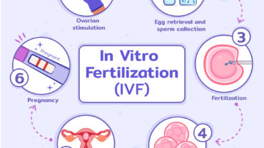 ivf