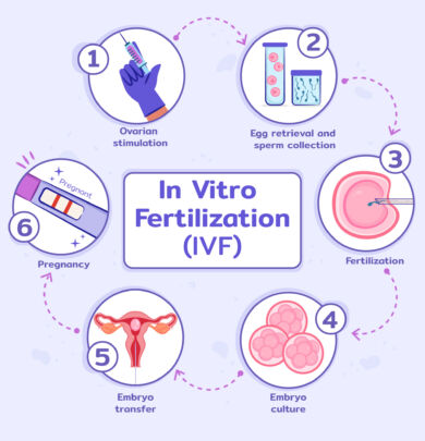 ivf