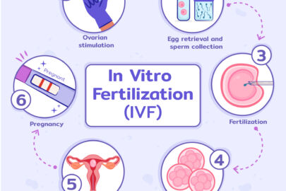 ivf