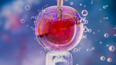 Blastocyst Culture in IVF