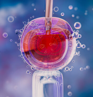 Blastocyst Culture in IVF