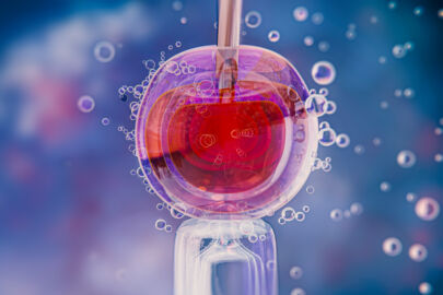 Blastocyst Culture in IVF