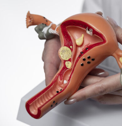 IVF for PMOS Patients